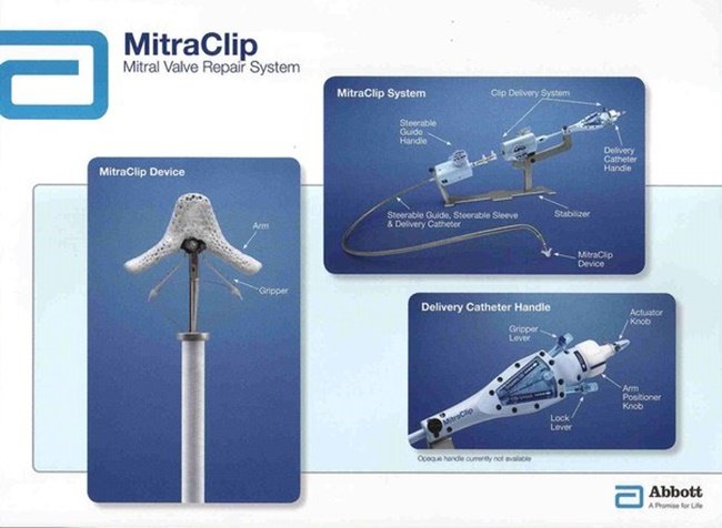 Abbott với chiến lược cân bằng
